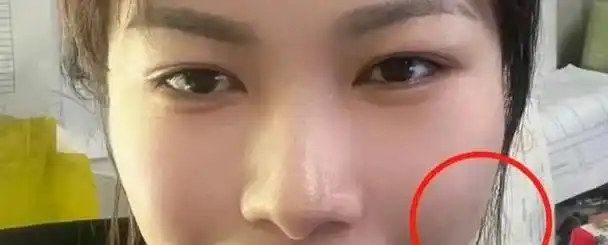 山根|面相学_网易订阅