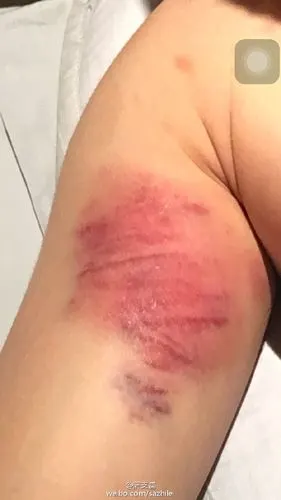 杨洋拍戏狂用替身? 吊钢丝「惊悚血痕」伤照曝光