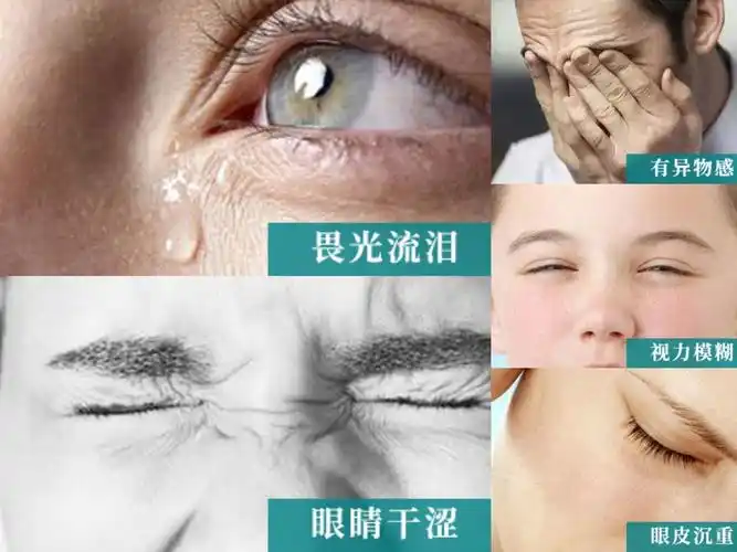 患者的福音,安康市中心医院引进冶疗干眼新设备 写美篇干眼的常见症状