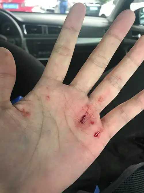 三星手机炸伤小女孩是怎样让一个纪录片工作者在信访局被围攻的