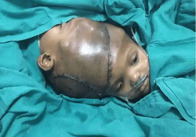 畸形的连体兄弟,去美国后暴富,娶英国姐妹,四人生下22个娃