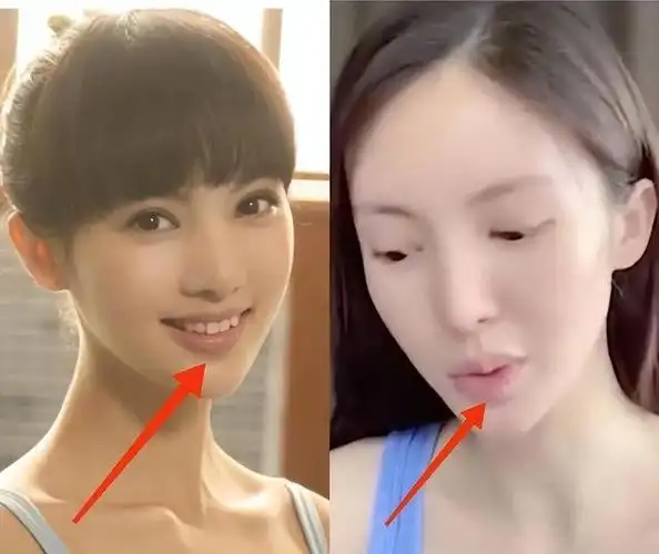 金晨将出演《庆余年2》,被批整容过度歪嘴大怒,网友:掩耳盗铃