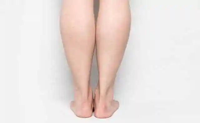 小腿内侧腓肠肌怎么减小腿腓肠肌发达该怎么瘦