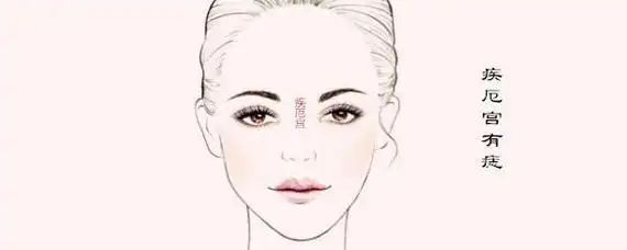 厄警失痣是什么意思