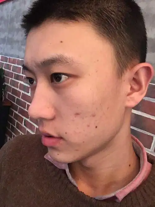 五官好看 皮肤不好是什么体验?