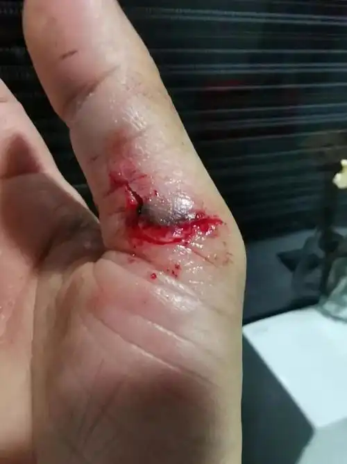 去星耀樟宜玩最新游乐项目,竟导致脚卡网中,满手都是血