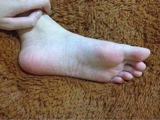 男人脚上出现这三个信号,说明身体出了问题了,别傻傻不知道了