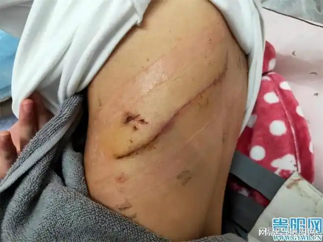 生死时速女子刀伤危重医护人员抢救1个多小时化险为夷