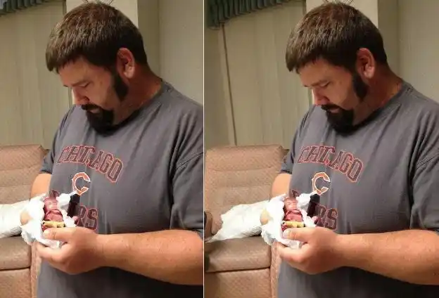 世界上最小的婴儿,比巴掌还小,现状让很多人"失望"了