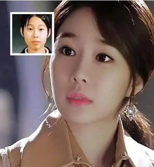 韩国女明星整容前后对比图,觉得已经没有人能阻止韩国人民了