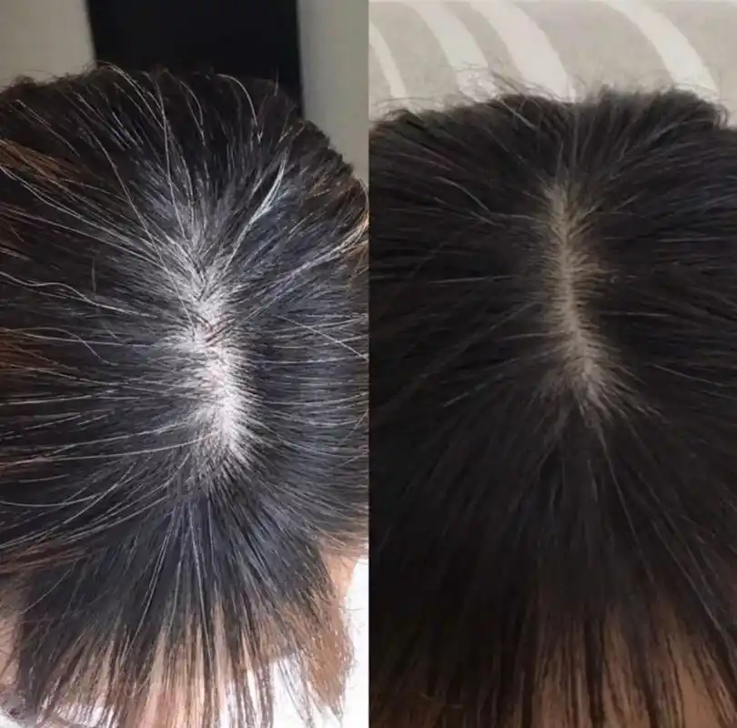 两鬓,黑中一片白~ 后脑勺的自己还看不见~  年纪轻轻的~ 不要让白发