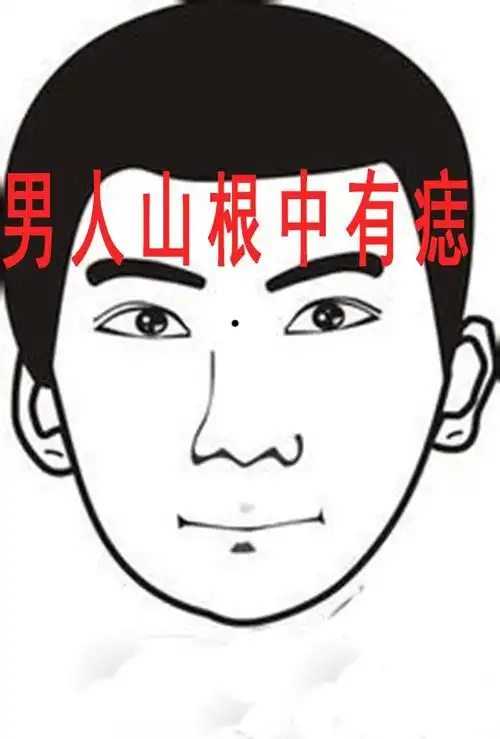 男人脸上长痣图解大全,这3种痣相的男人-相术-荣耀易学