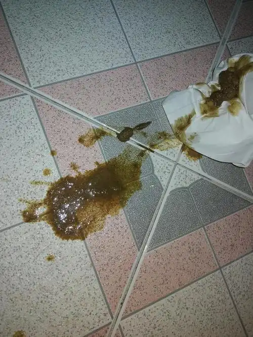 讨论求大家帮看下褐色呕吐物像屎一样是怎么回事啊