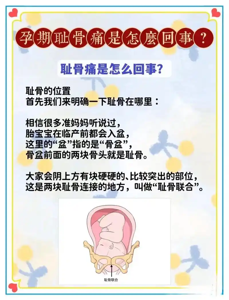 耻骨痛到底是哪里痛?#准妈妈 - 抖音