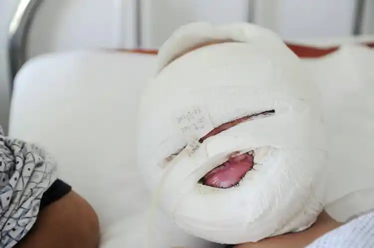 晚上小朋因为感冒高烧41度多,经医院及时治疗后今日体温已经恢复正常