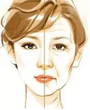 面部衰老,皮肤松弛的人,做自体脂肪填充效果好不好?