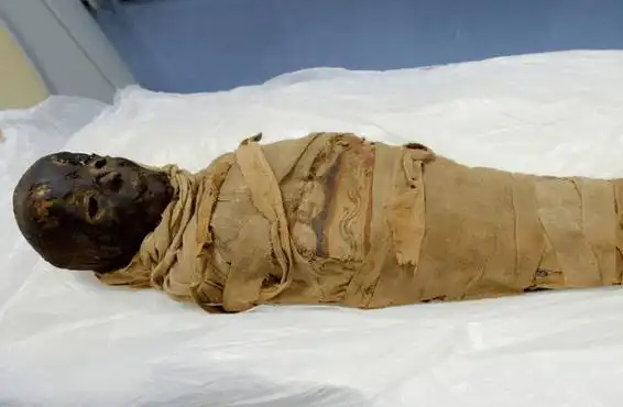 八旬老太怀孕46年后产下木乃伊 太神奇了