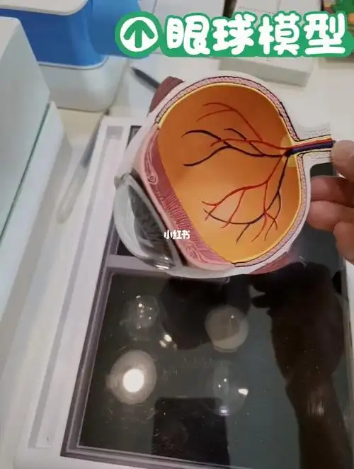眼球模型