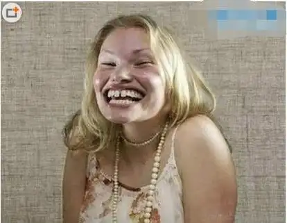 真实的丑女图片欣赏,能看完算我输(世界上最丑的女人揭晓)