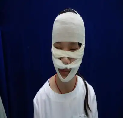 医院-在实践中创新 ---------皮肤二病区开展护理头面部手术伤口包扎