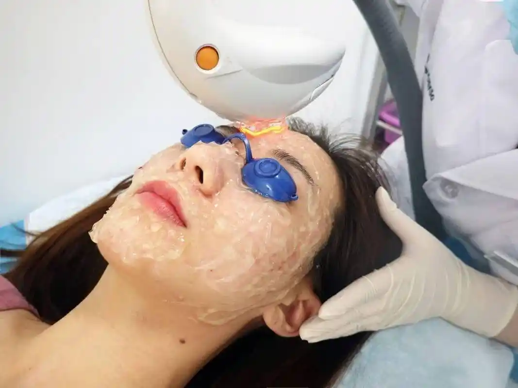 记一次真实的光子嫩肤体验仿佛打开了新世界