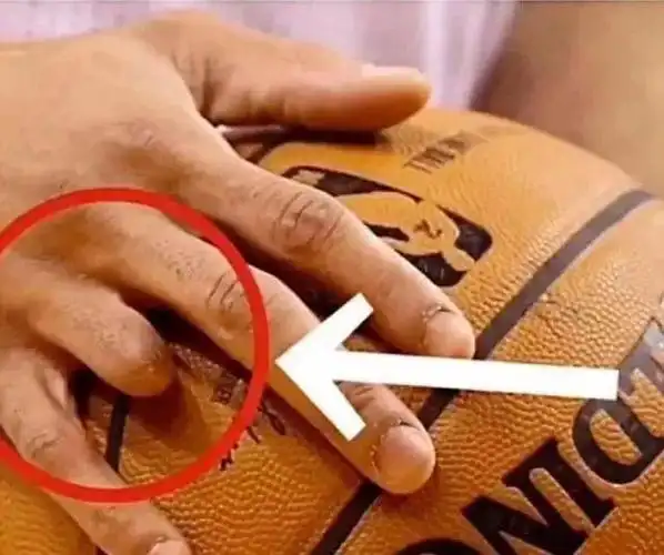nba 9指为什么(九指格林:只有九个指头,为何非要到nba混)