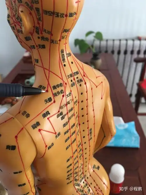 拔罐调理病症之肩周炎