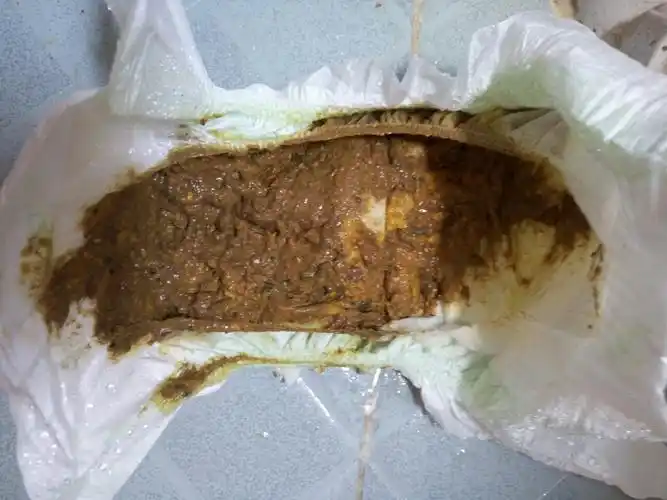 我姑娘一岁,这几天都是拉这样的大便,食欲不好,吃什么都是几口就不吃