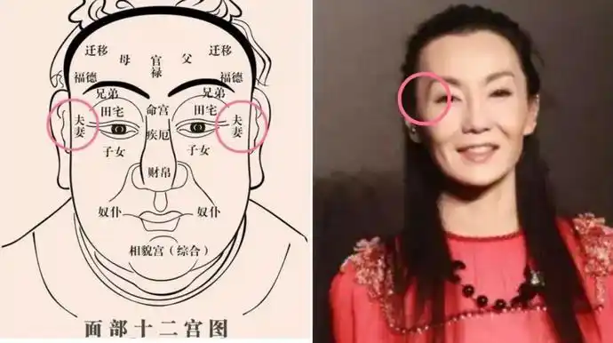 张曼玉爆瘦后夫妻宫出现了明显凹陷的问题