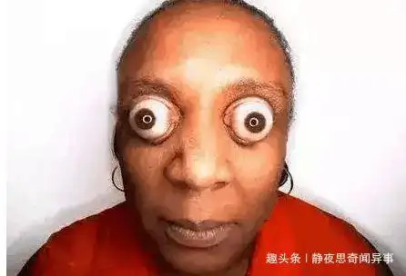 直击全世界最恐怖的5双变异人眼他的眼会抽烟