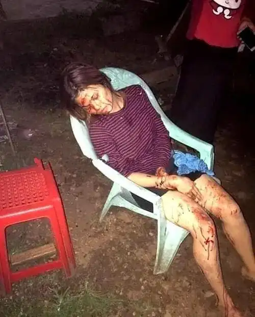 遍体鳞伤缅甸摩托车上的2名女孩遭遇抢手机