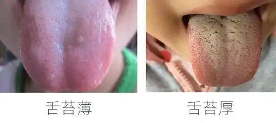 睡不久?真相80%的家长都想不到!_舌苔