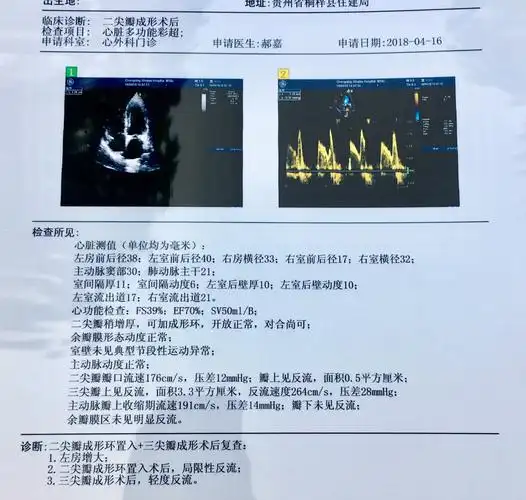 二尖瓣关闭不全是直接换瓣还是先考虑成形修复
