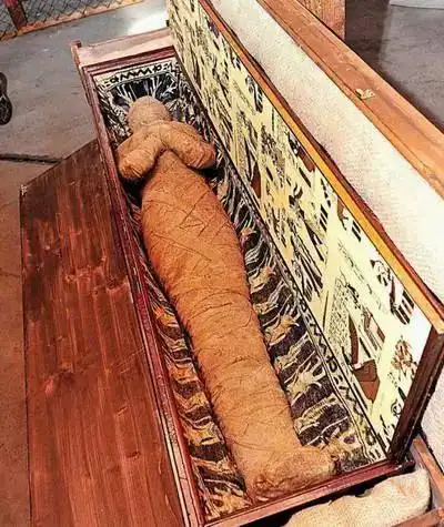 木乃伊竟然安上心脏起搏器?是外来生物装上去的吗?