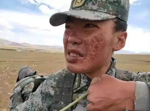 西藏边防驻地平均海拔4000多米,高寒缺氧,条件艰苦,气候恶劣.