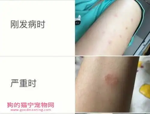 猫癣也是会传染给人的,犬小孢子菌和须毛癣菌可以随着猫咪的毛发和