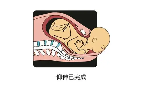 揭秘分娩全过程,宝宝为了出生也是拼了