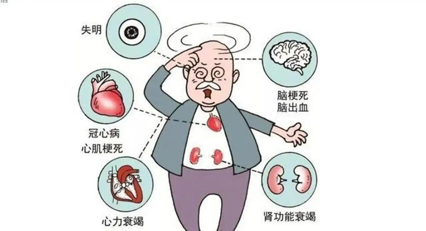 指高血压,高血脂,高血糖等,三种疾病都比较严重,不能诊断哪个危害最大