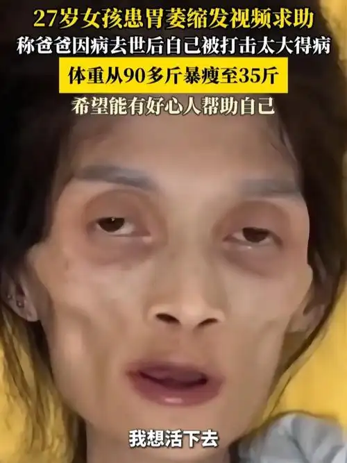 27岁女孩患胃萎缩发视频求助,体重从90多斤暴瘦至35斤