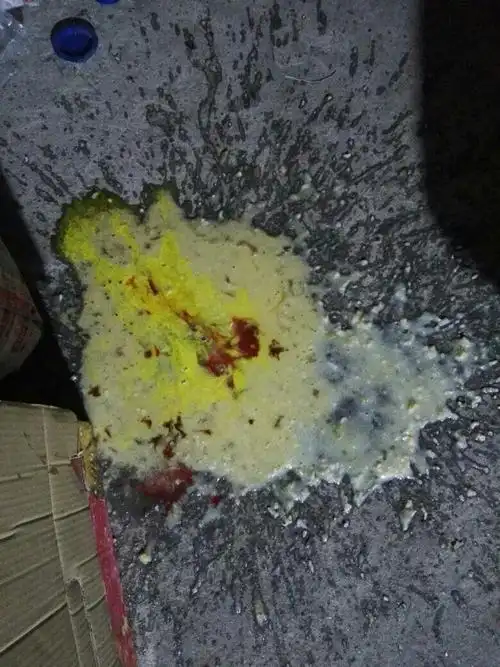 半夜呕吐有黄水