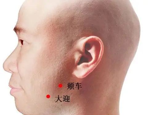 面瘫艾灸疗法艾灸怎么治疗面瘫