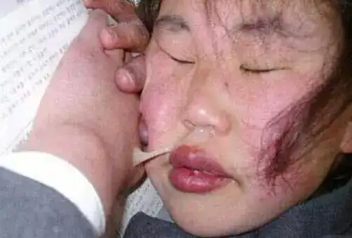 世界上最丑的女人排行榜,心脏不好别看!