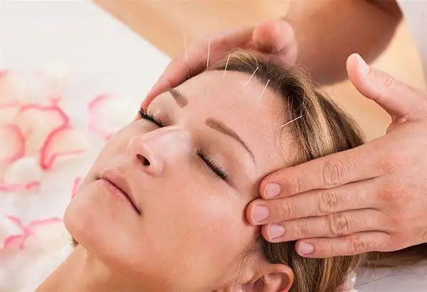 一觉醒来嘴歪眼斜以为中风是颜面神经麻痹针灸穴位修复