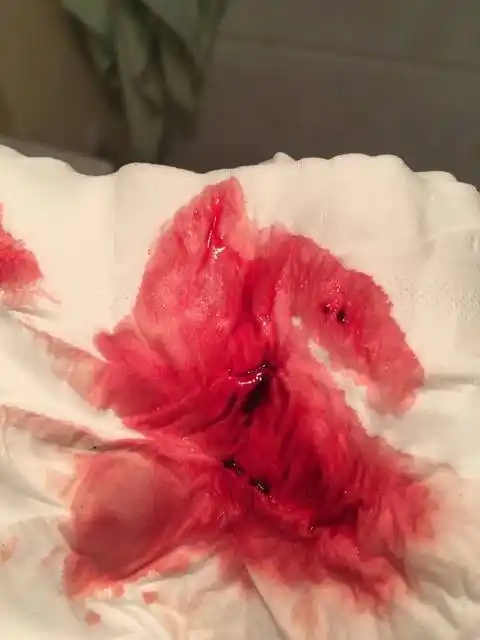 无非血尿心电图b家园网超等,跟着医生流程走就行了.13药流全程怎么走?