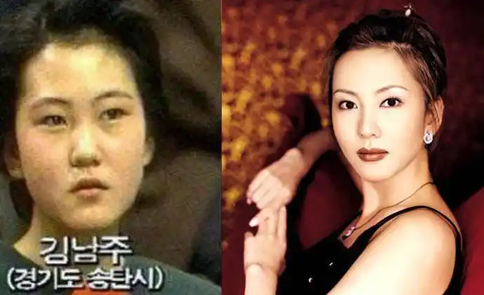 金南珠整容前后对比照曝光, 整得十分成功, 帅气老公将其宠上天