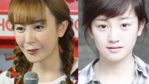 越来越多明星为了最求更完美的自己,为了保住年轻的外貌而选择整容