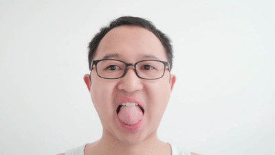 面瘫是一种什么样的体验?