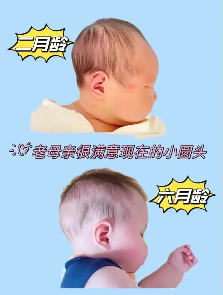 睡出漂亮小圆头