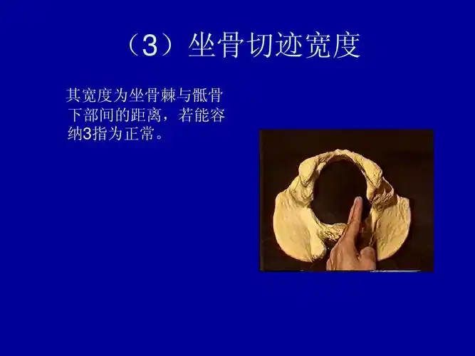 (3)坐骨切迹宽度 其宽度为坐骨棘与骶骨 下部间的距离,若能容 纳3指为