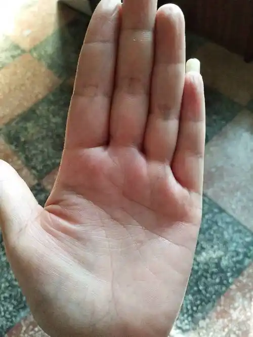 有没有大师给看一下手像纹路比别人的多又乱两只手都这样多出来好多纹